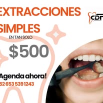 Promoción 2